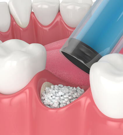 Dentist in Buckeye AZ