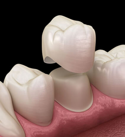 Dentist in Buckeye AZ