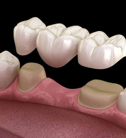 Dentist in Buckeye AZ