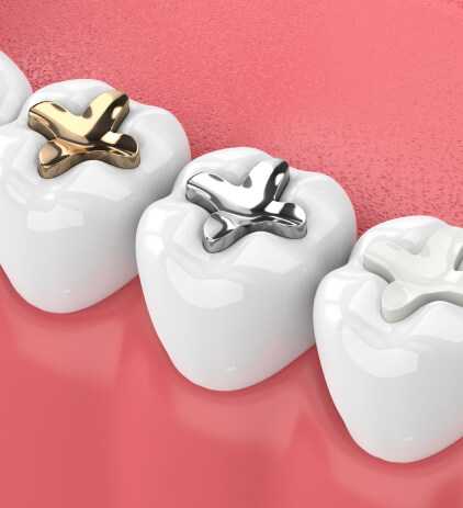 Dentist in Buckeye AZ